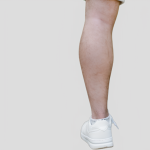 Épilation Homme - Jambes entières (Carte cadeau 🎁)